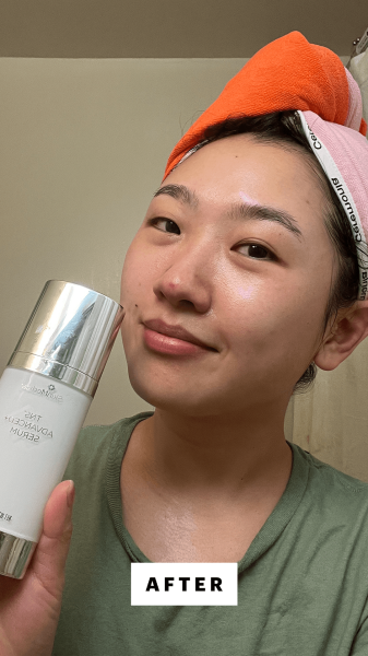Han after applying SkinMedica TNS Advanced Serum to her face